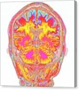 Human Head And Brain #1 Canvas Print