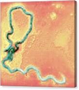 Syphilis Bacterium #1 Canvas Print