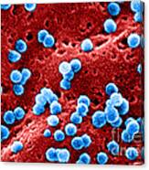 Human Immunodeficiency Virus #3 Canvas Print