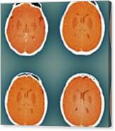 Brain In A Coma #4 Canvas Print