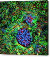 Cancer Cells Canvas Print