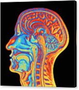 Coloured Mri Scan Of The Human Head (side View) Canvas Print