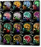 Coloured Sagittal Mri Scans Of The Human Brain Canvas Print