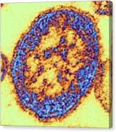Measles Virus Particle Canvas Print