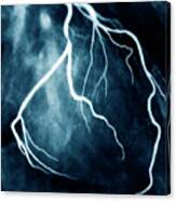 Narrowed Coronary Artery Canvas Print