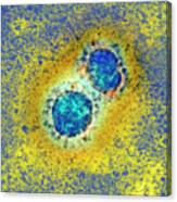 Sars Virus Particles Canvas Print