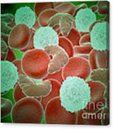 Sickle Cell Anemia With Red Blood Cells Canvas Print