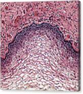 Stratified Squamous Epithelium, Lm Canvas Print
