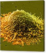 Prostate Cancer Cell, Sem #1 Canvas Print