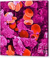 Red Blood Cells, Sem #10 Canvas Print