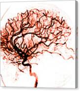 Cerebral Angiogram Canvas Print