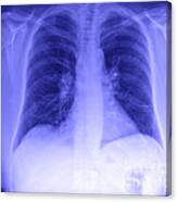 Chest X-ray Canvas Print