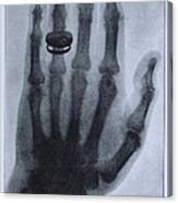 Konrad Roentgens X-ray Of The Hand Canvas Print