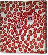 Lm Of Human Blood Smear Showing Red & Canvas Print