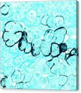 Pancreatic Cancer Cells Canvas Print