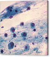 Pap Smear, Nucleated Yeast Canvas Print