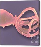 Defective Human Sperm Canvas Print