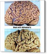 Healthy And Alzheimer Brains, Gross Canvas Print