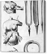 Breast Surgery, 1751-1777 #1 Canvas Print