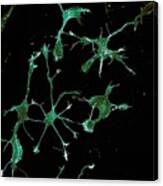 Brain Cell Showing Cytoskeleton Canvas Print
