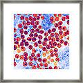 Hiv Particles, Tem #1 Framed Print