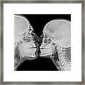 X-ray Kissing #1 Framed Print