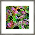 Osteosarcoma Cells #10 Framed Print