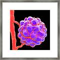 Tumour #3 Framed Print