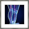 Vascular System, Artwork #5 Framed Print