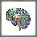 Human Brain #7 Framed Print