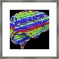 Brain #9 Framed Print