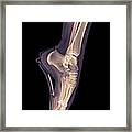 Ballet Dancer X-ray 3 Framed Print