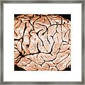 Brain Of Helen Hamilton Gardener Framed Print
