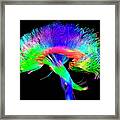 Brain Pathways Framed Print