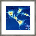 Cancer Cells Framed Print