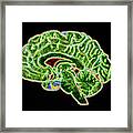 Coloured Ct Scan Of A Healthy Brain (side View) Framed Print