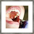 Dental Cleaning Close-up Framed Print