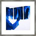 Doctor Views X-rays Framed Print