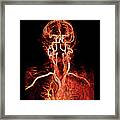 Head And Neck Arteries Framed Print