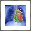 Heart Framed Print