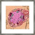 Herpes Simplex Virus, Tem Framed Print