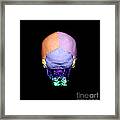 Human Skull Framed Print