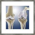 Knee Flexion Anatomy, Artwork Framed Print