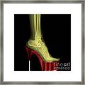 Stiletto High-heeled Shoe Framed Print