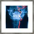 Blood Supply Of Head And Neck #2 Framed Print