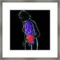 Abdominal Pain, Conceptual Artwork #5 Framed Print