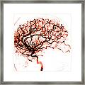 Cerebral Angiogram Framed Print