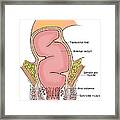 Illustration Of Rectum #5 Framed Print