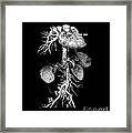 Abdominal Aorta #6 Framed Print