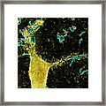 Helicobacter Pylori Bacteria, Sem #8 Framed Print